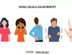 KENALI GEJALA CACAR MONYET