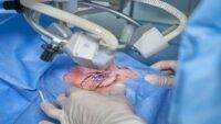 LASIK Mata: Terobosan untuk Penglihatan Lebih Jernih