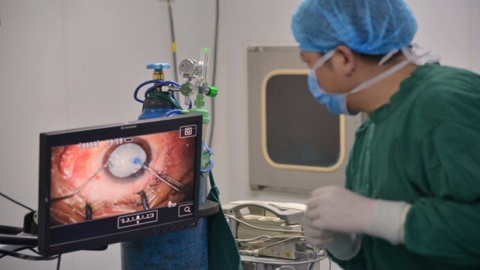 ilustrasi operasi mata katarak
