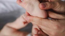 Eksim pada Bayi: Apa Penyebabnya dan Skincare Apa yang Aman Digunakan?