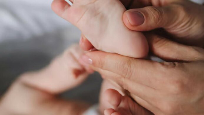 Eksim pada Bayi Apa Penyebabnya dan Skincare Apa yang Aman Digunakan