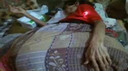 Bantu Donasi Lur, Ibu Satem Warga Bajing Kulon Kroya Cilacap Tidak Punya Biaya untuk Operasi