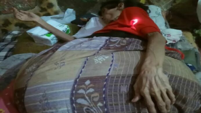 Ibu Satem Warga Bajing Kulon Kroya Cilacap Terkena Penyakit dan tidak punya biaya untuk operasi
