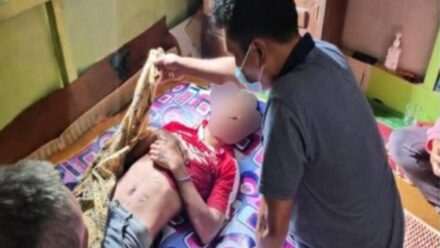 Pasang Lampu Hias, 1 Remaja di Dayeuhluhur Meninggal Tersengat Listrik